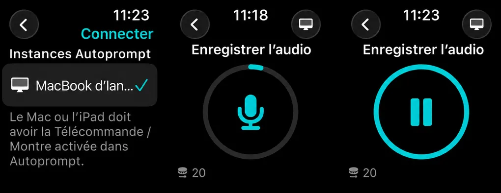 Trois écrans d’Apple Watch: choisir un appareil, un bouton de démarrage du microphone avec un anneau de progression et un bouton de pause